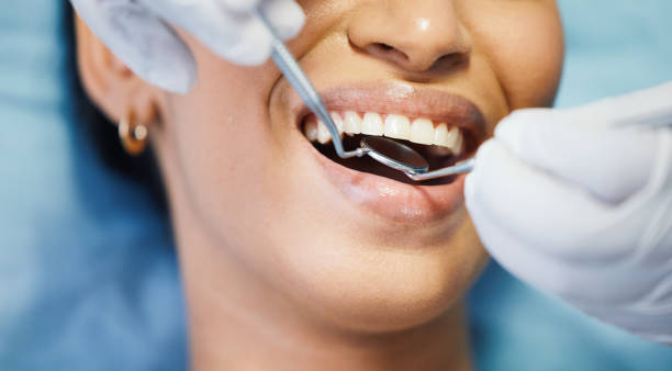 Best Emergency Dentist for Knocked-Out Tooth in Carrboro, NC